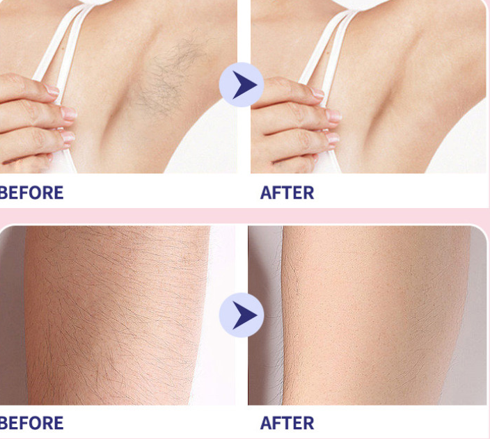 Hanahime hair removal cream